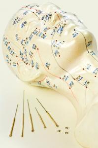 model of head with acupuncture points and needles