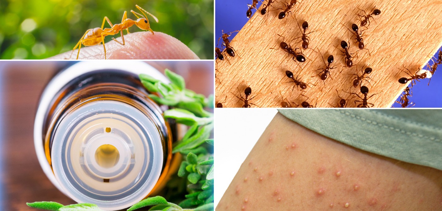 Best 7 Well-Known Essential Oils for Fire Ant Bites (That Really Work ...